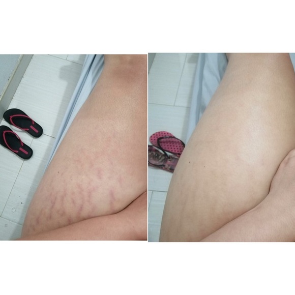 Meet your Posher, MB Distributor, LLC - Picture 14 of 17